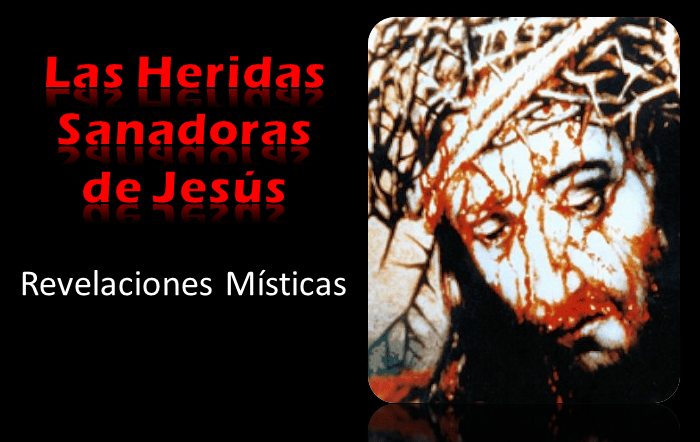 The Healing Wounds of Jesus SP